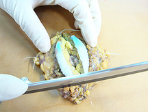 乳がん手術材料の切り出しの写真